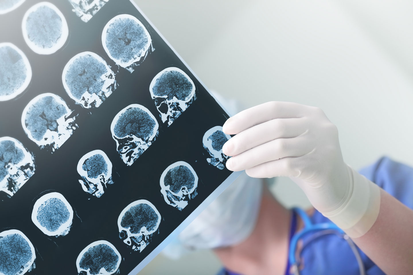 Traumatic Brain Injury